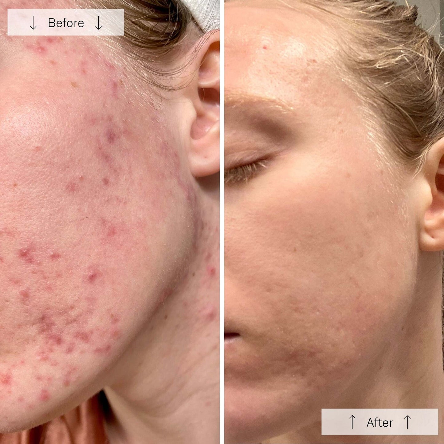 Muriva™ LED Face Mask